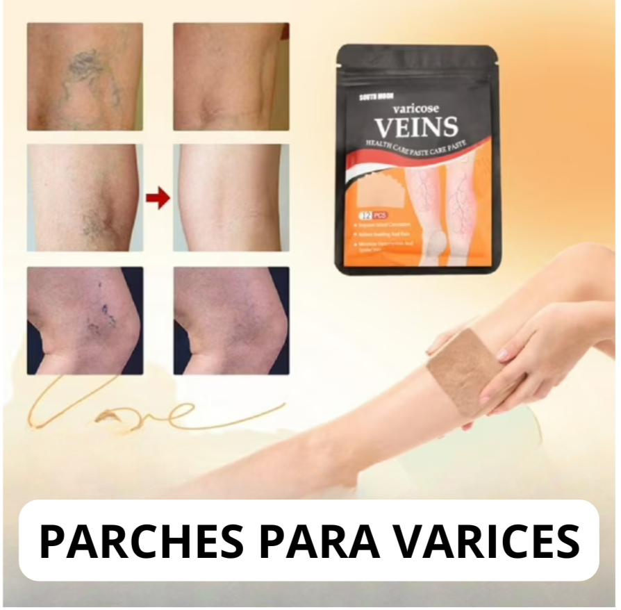 Veins - ADIÓS VARICES ™ Vuelve a tener tus piernas sanas‼️
