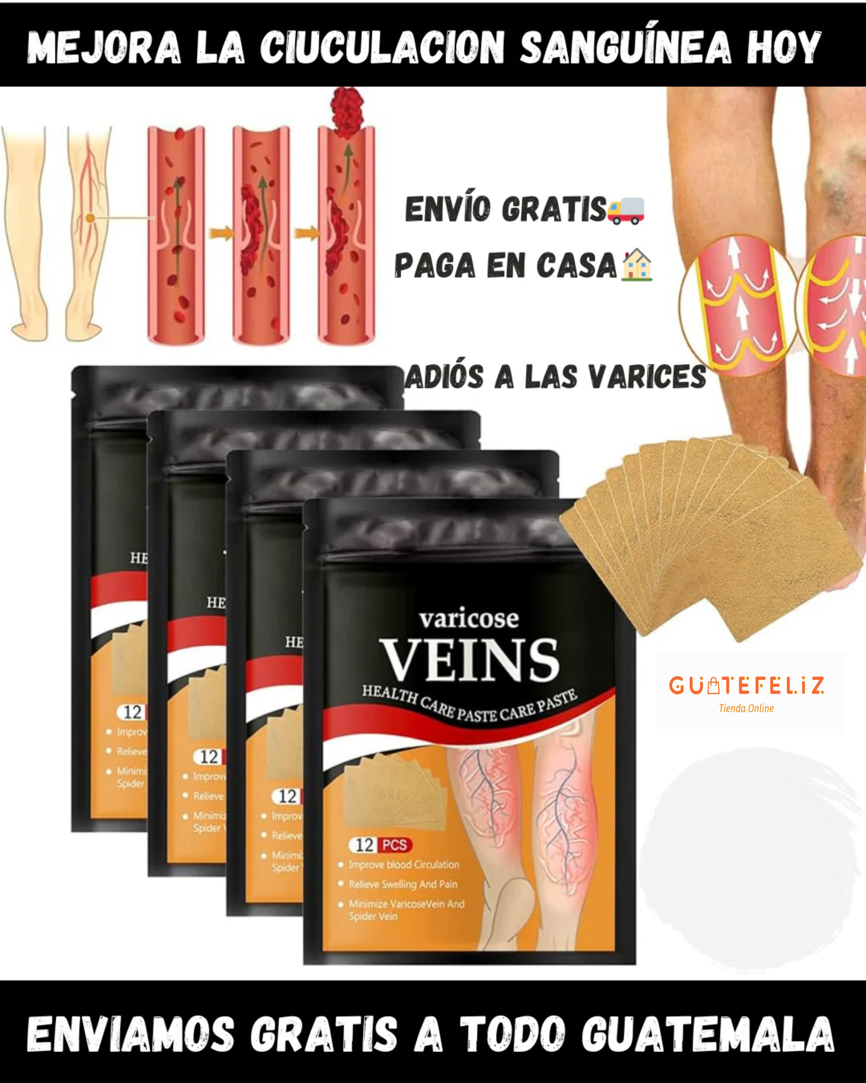 Veins - ADIÓS VARICES ™ Vuelve a tener tus piernas sanas‼️